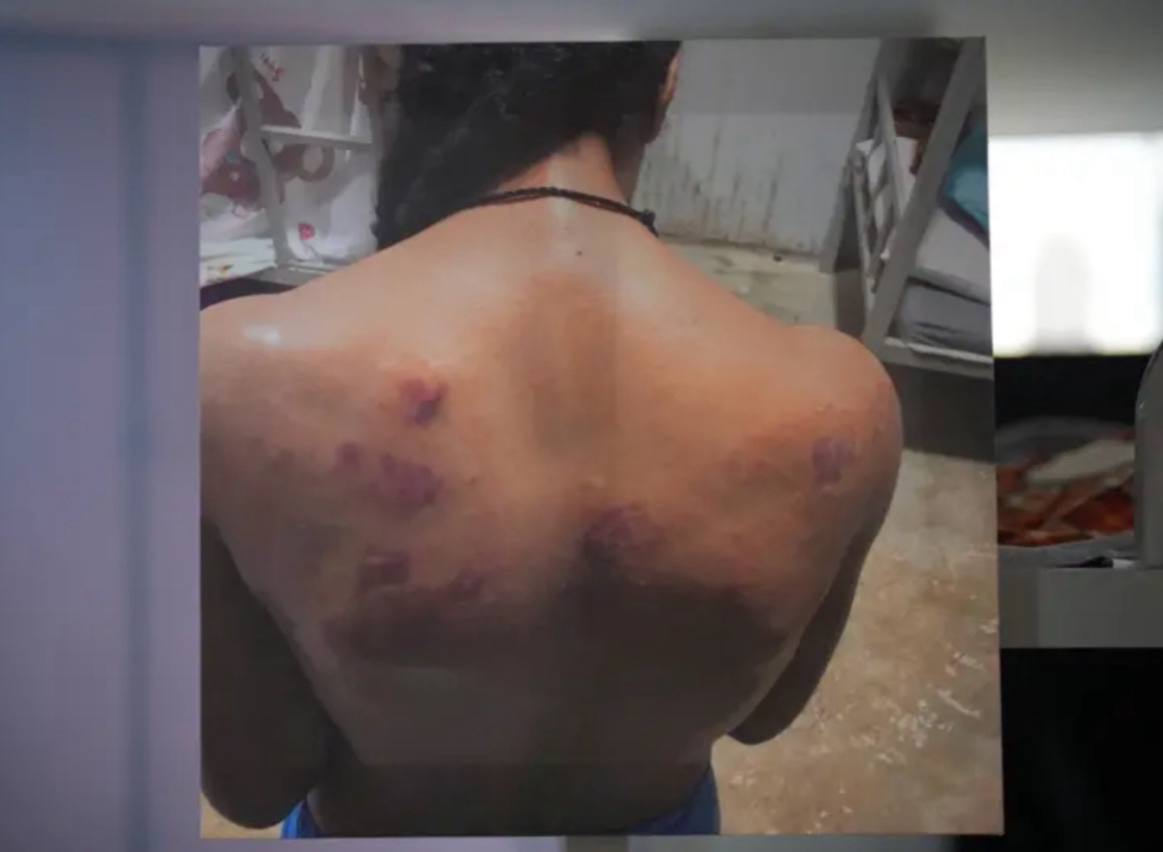 曼谷外国记者协会正在举办一场展览,讲述缅甸妙瓦底诈骗园区受害者遭遇的虐待